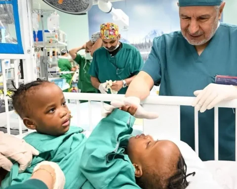 Separation Surgery for Tanzanian Conjoined Twins Begins in Riyadh