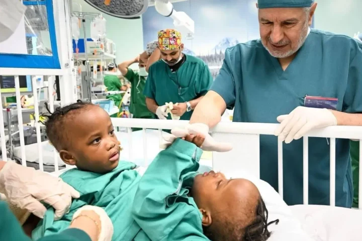 Separation Surgery for Tanzanian Conjoined Twins Begins in Riyadh