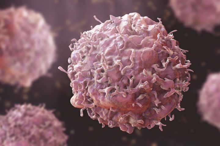 WHO Warns Global Cancer Cases Could Reach 35 Million a Year by 2050