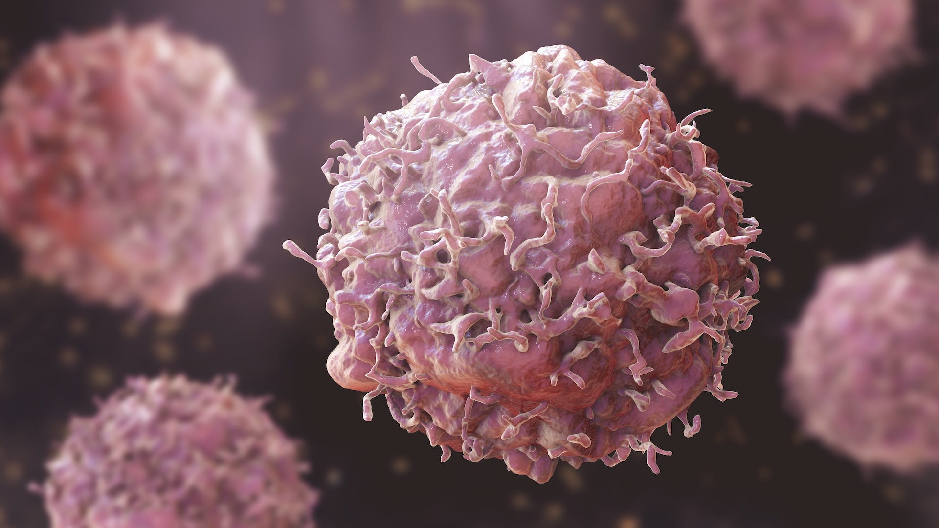 WHO Warns Global Cancer Cases Could Reach 35 Million a Year by 2050