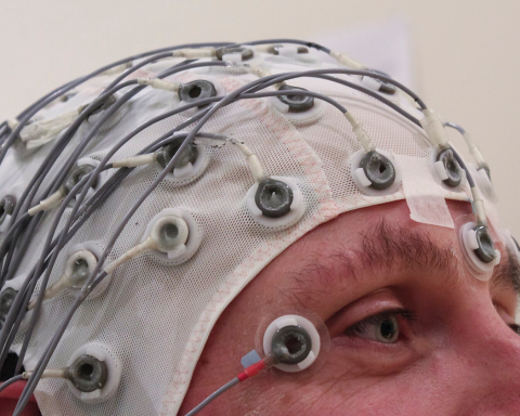 A brain map first, then magnetic pulses: the cleared PTSD treatment reporting 68% remission