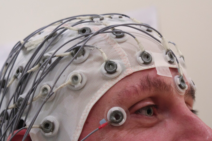 A brain map first, then magnetic pulses: the cleared PTSD treatment reporting 68% remission