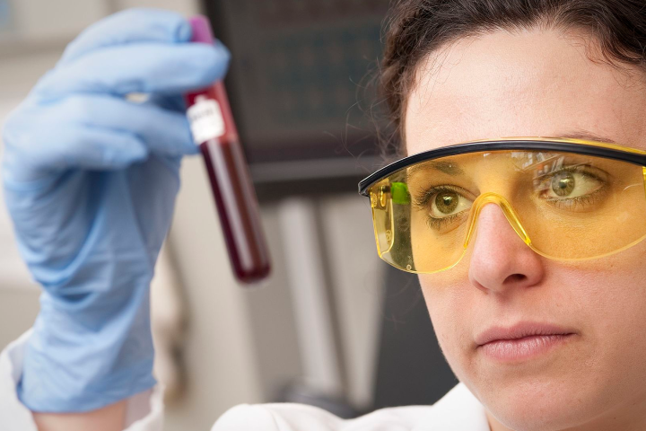 Antibody patterns in blood point to Crohn's and colitis a decade ahead