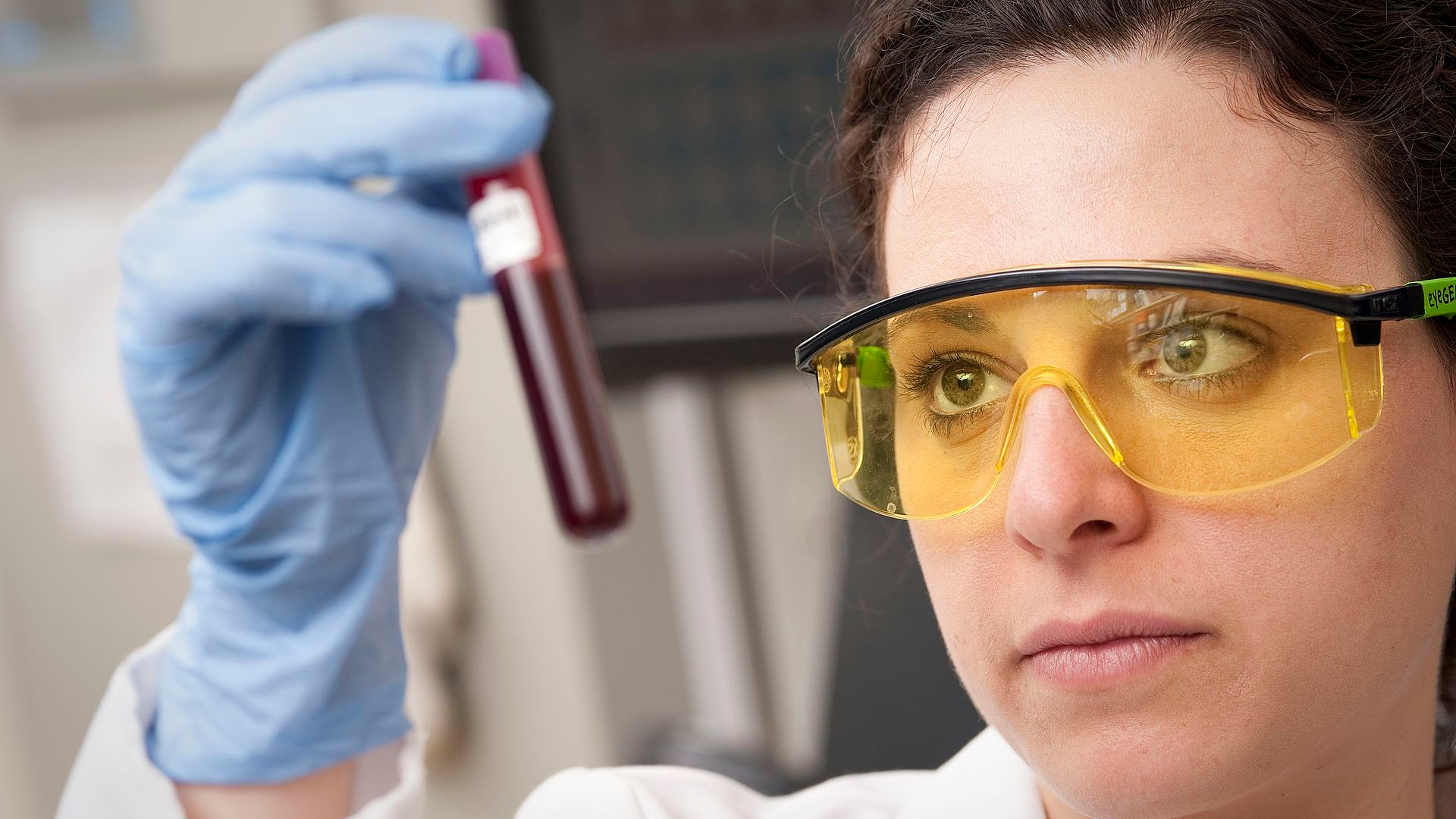 Antibody patterns in blood point to Crohn's and colitis a decade ahead