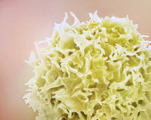 Overlooked immune cells can find and kill small cell lung cancer, Melbourne team reports