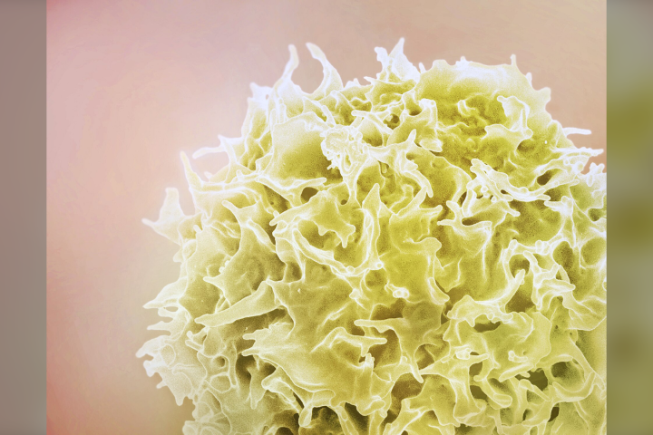 Overlooked immune cells can find and kill small cell lung cancer, Melbourne team reports