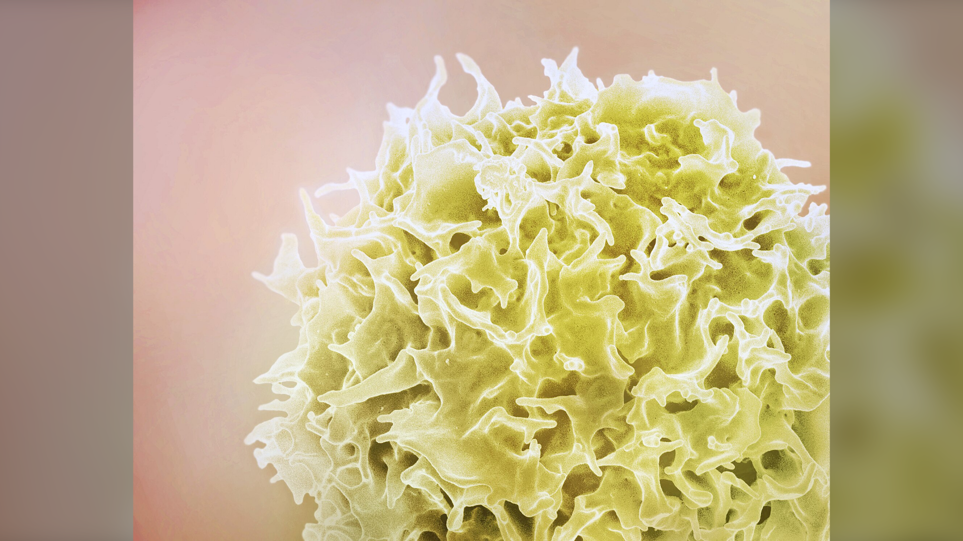 Overlooked immune cells can find and kill small cell lung cancer, Melbourne team reports