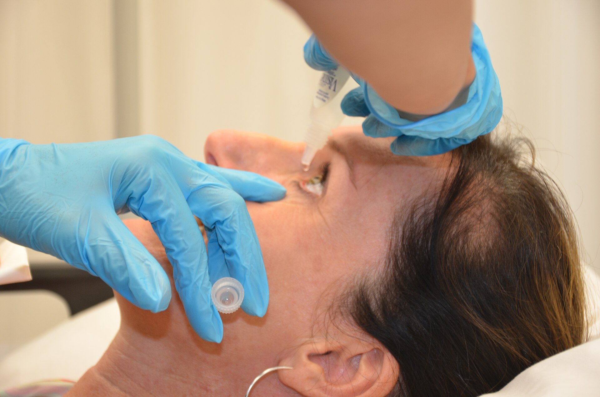 Ryzumvi, a drop that reverses eye dilation, is now cleared in the US for age-related near vision loss