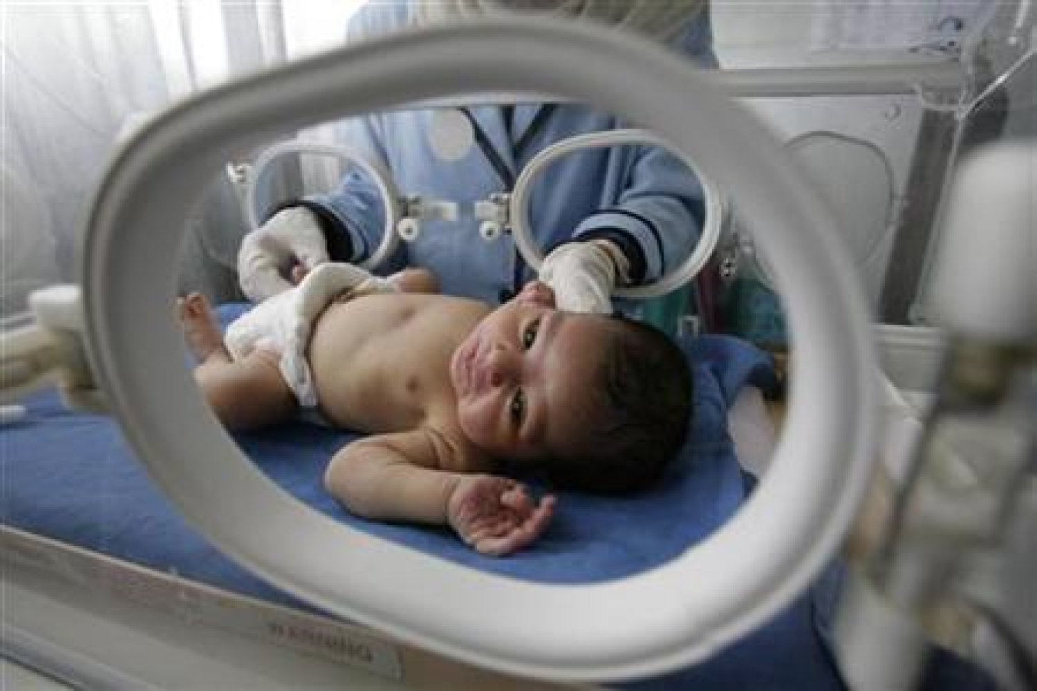 وفاة طفل حديث الولادة بعد إعطائه غاز الضحك بدلاً من الأكسجين