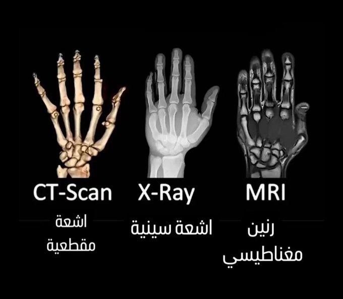 الفرق بين الرنين المغناطيسي والأشعة السينية والأشعة المقطعية