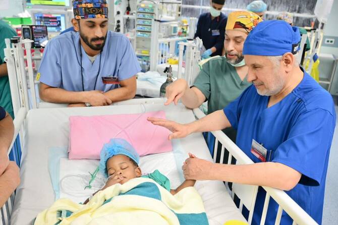أطباء المملكة ينجحون في فصل التوأم السيامي الجامايكي أزاريا وأزورا في عملية معقدة بالرياض