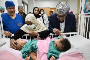 بدء عملية فصل التوأم السيامي الصومالي «رحمة ورملا» في الرياض